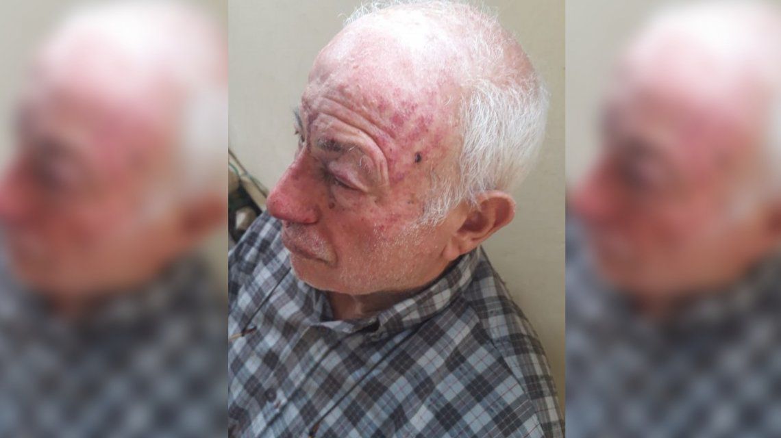 Encapuchados golpearon y maniataron a una pareja de jubilados en Luis Guillón