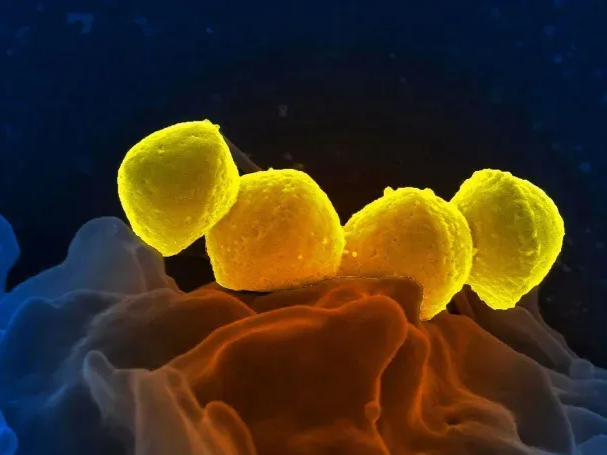 Streptococcus pyogenes: aumentan los casos y ya hay 93 muertos