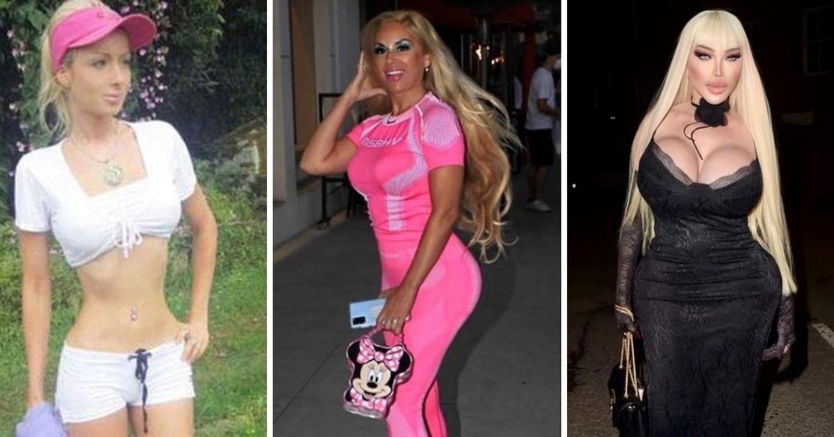 “Barbies humanas”: la sexualización y los peligros de las modelos que “quieren ser muñecas”