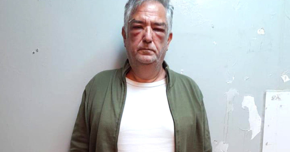 ANDIS: Miguel Ángel Calvete busca la libertad en la causa en la que está condenado por proxenetismo