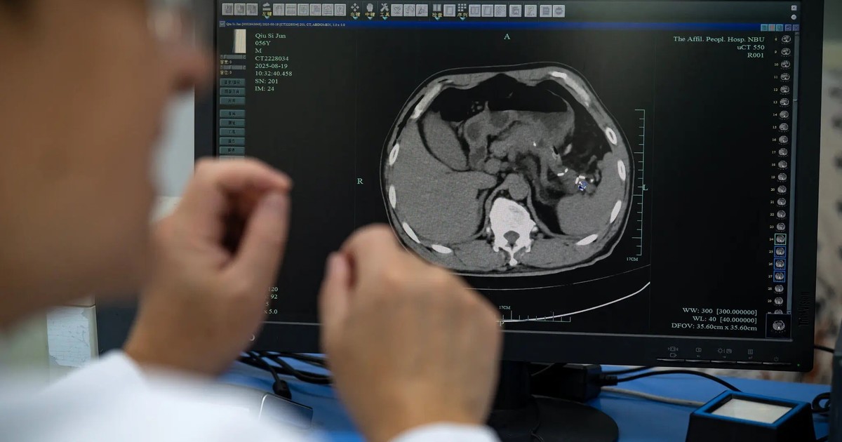 En China, la IA está detectando tumores mortales que los médicos podrían pasar por alto En China, la IA está detectando tumores mortales que los médicos podrían pasar por alto