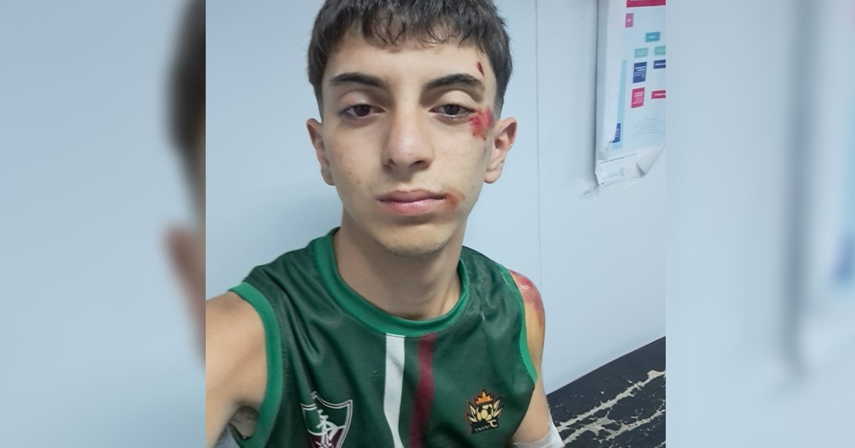 Tiene 18 años, es bombero voluntario y salió de su casa al sonar la sirena, pero le robaron la bici y le dieron una paliza